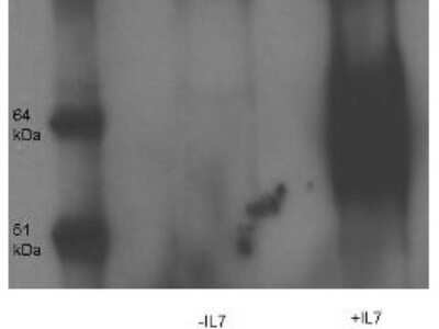 Western Blot: IL-7R alpha/CD127 [p Tyr449] Antibody [NB110-85537]